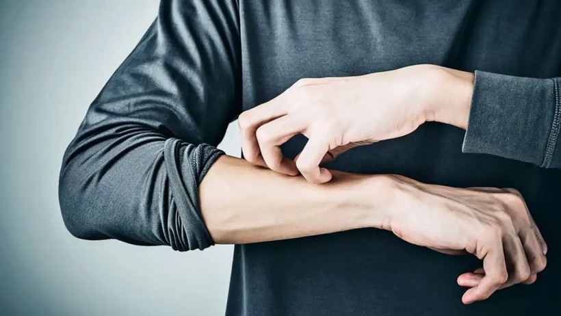 Böcekleri Düşünmek Bile Kaşındırıyor: Bilim İnsanları Sebebini Açıkladı - Resim : 2