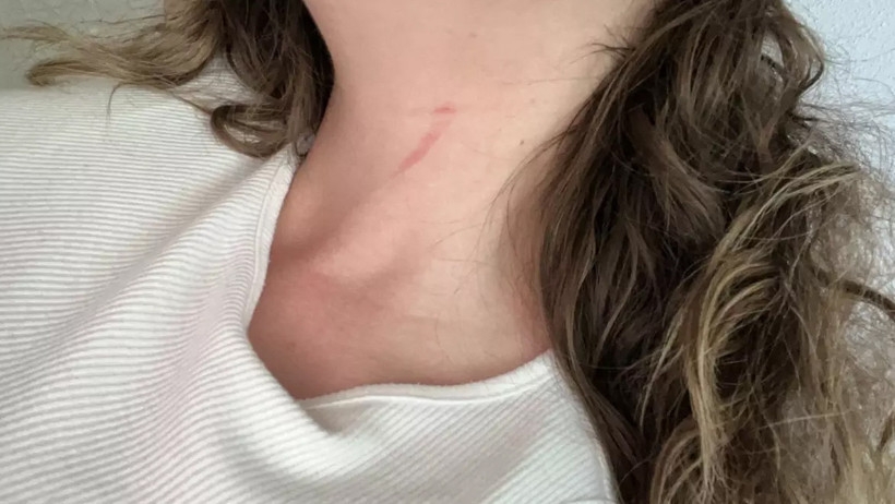 Genç Kadının Boğazına Bıçak Dayayıp Gasp Etti, Altınlarını Sahte Sanıp Almadı - Resim : 3