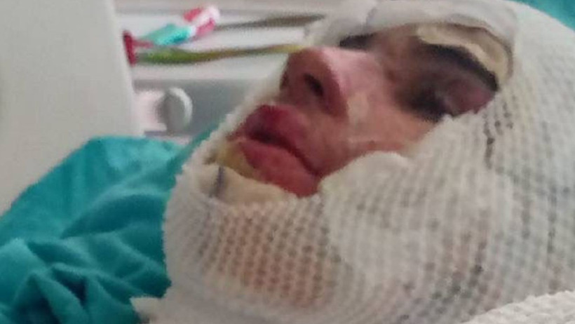 Adana'da 16 Yaşındaki Yeğenini Diri Diri Yakmıştı: Dehşet Saniye Saniye Kamerada - Resim : 1