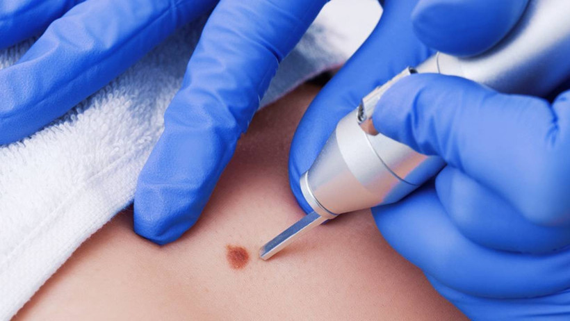 Güzellik Merkezindeki Ölümcül Tehlike! Basit Sandığınız Bu İşlem Hayatınızı Karartabilir - Resim : 1