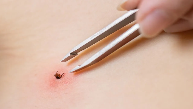 Grip Gibi Başlayıp Hayat Karartıyor! Yazın Görünmeyen Düşmanı Her Yerde… Sessizce Öldürüyor - Resim : 3