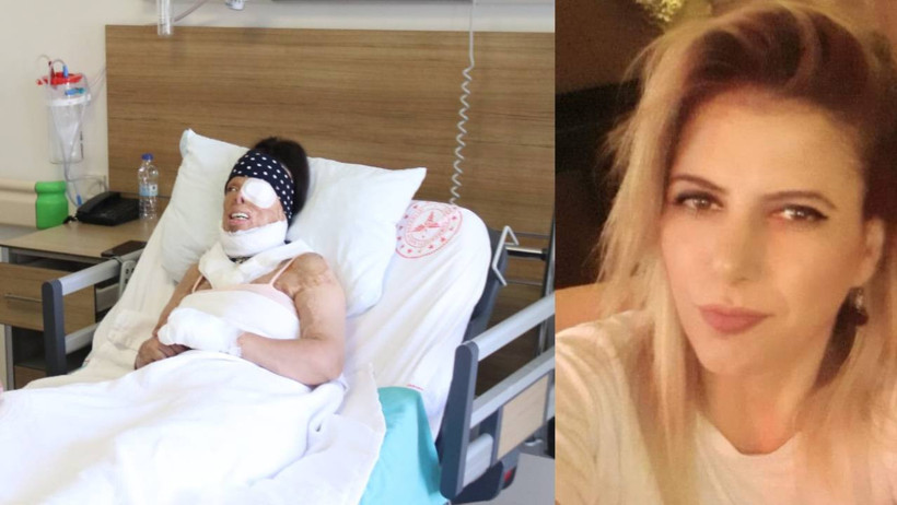 Kezzaplı Dehşet! Kıkırdakları Eridi, Gözü Aktı: Yüzünü Yıkayamasın Diye Elektriği ve Suyu Kesmiş... - Resim : 1