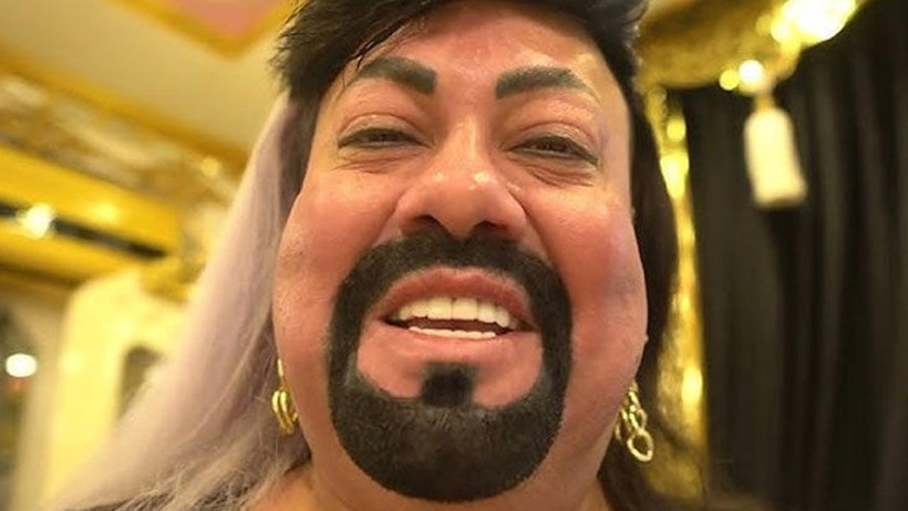 Kobra Murat’ın Son Hali Olay Oldu! Sosyal Medya İkiye Bölündü - Resim : 1