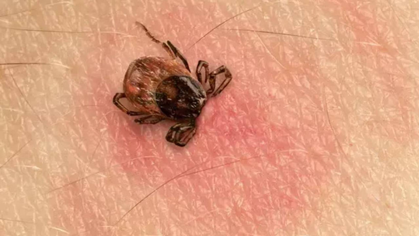 Karadeniz İçin Salgın Uyarısı: Baş Ağrısı, Halsizlik, Kas Ağrısı Yaşıyorsanız Aman Dikkat! Ölüme Kadar Götürüyor - Resim : 2