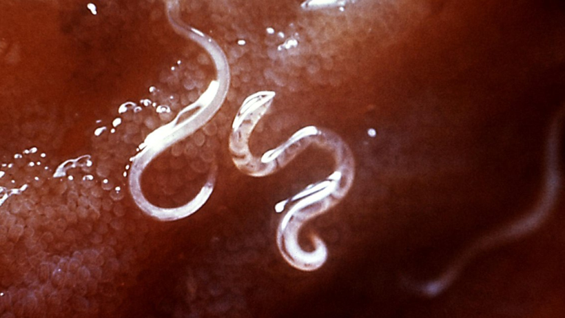 Vücuda Acısız Şekilde Nüfuz Ediyor, Gizli Gizli Kansere Götürüyor! Avrupa'da Görülmeye Başladı - Resim : 2