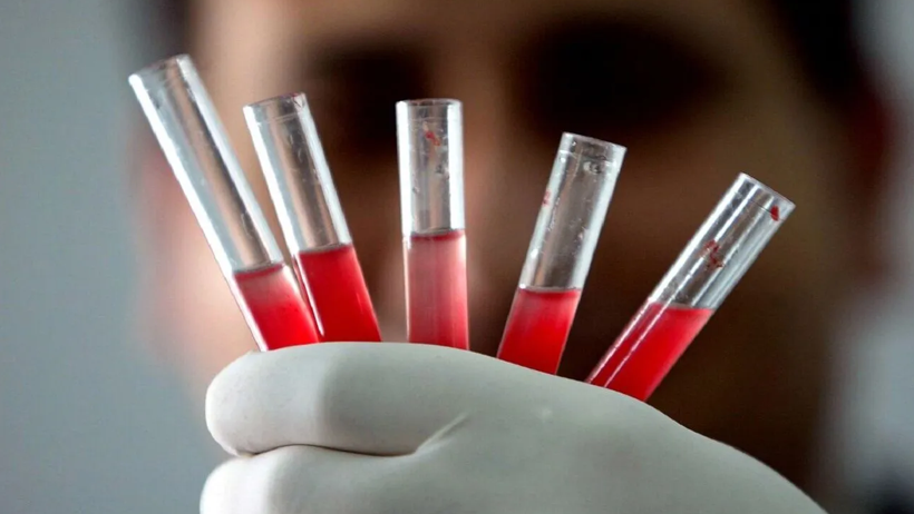 Dünyada Sadece Bir Kişide Görülen Yeni Kan Grubu Keşfedildi - Resim : 2