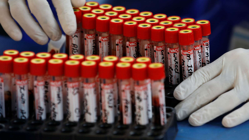 Dünyada Sadece Bir Kişide Görülen Yeni Kan Grubu Keşfedildi - Resim : 1