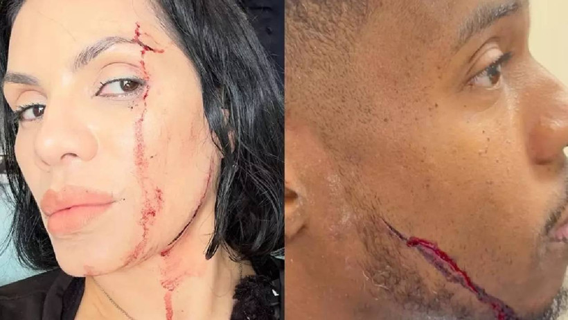 Film Değil Gerçek! Yemek Videosu Çeken Fenomenlere Araba Çarptı: İşte Akılalmaz O Anlar - Resim : 2