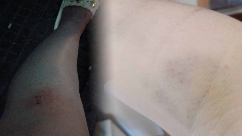 Bursa’da Eski Eş Dehşeti! Çocuklarını Teslim Ederken Saldırıya Uğradı - Resim : 2