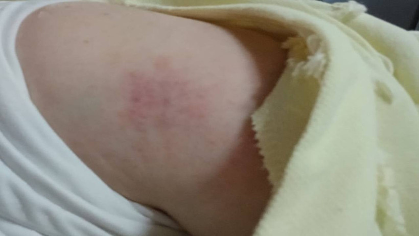 Bursa’da Eski Eş Dehşeti! Çocuklarını Teslim Ederken Saldırıya Uğradı - Resim : 1