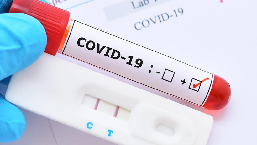 Koronavirüs Kabusu Geri mi Dönüyor? Yeni Varyantlar, Artan Vakalar… Acil Servisler Alarm Veriyor - Resim : 1