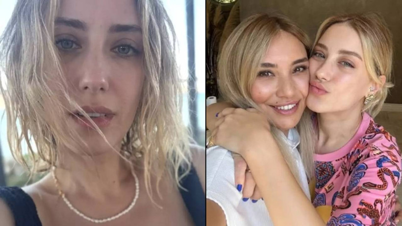 Hazal Kaya’nın Yüzündeki Değişim Olay Oldu! Herkes Aynı Yorumu Yaptı - Resim : 2