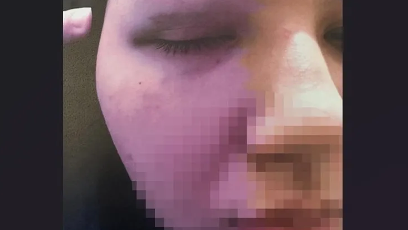 Her Detayı Kan Donduran Dava! Cinsel Saldırı, Tehdit, Yaralama… Hem Eşine Hem Kızına Dehşeti Yaşattı - Resim : 1