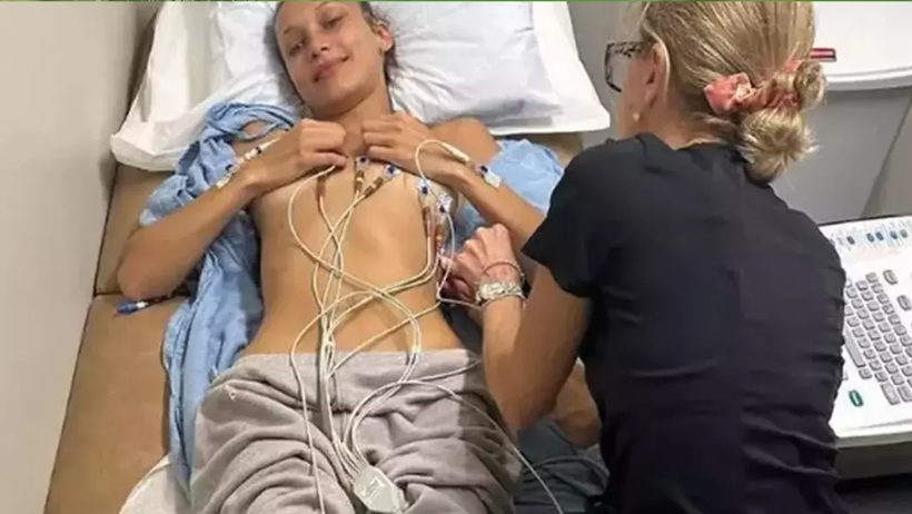 Podyumların Yıldızı Ünlü Model Bella Hadid Yeniden Hastanelik Oldu! 15 Yıllık Acı, 100’den Fazla Tedavi - Resim : 1
