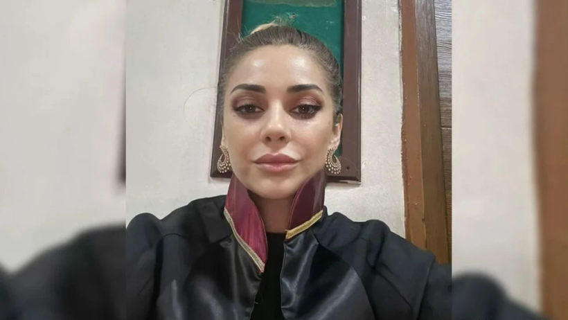 Dilan Polat’ı Sarıp Sarmalayıp Öpücüklere Boğmuştu! Feyza Altun Sessizliğini Gözdağı ile Bozdu - Resim : 2