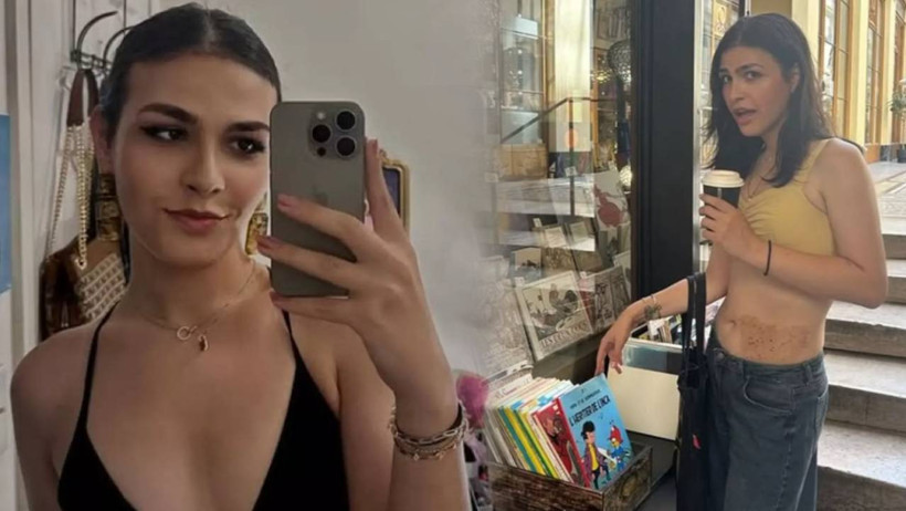 Çiçek Dilligil ve Bora Öztoprak’ın Çocuğu Cinsiyet Değiştirmişti! İsmini Ayda Yapan Ardahan Öztoprak'ın Son Halini Gören İnanamadı - Resim : 2