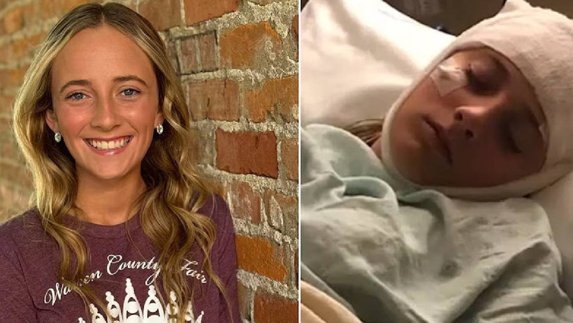 Filmleri Aratmayan Hikaye: Zaman Onun İçin 2019'da Durdu! Her 2 Saatte Bir Hafızası Siliniyor - Resim : 3