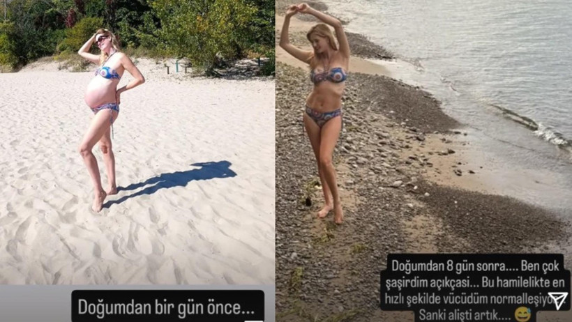 Wilma Elles Doğumdan Sadece 8 Gün Sonra Ortaya Çıktı! Görenler Gözlerine İnanamadı - Resim : 1