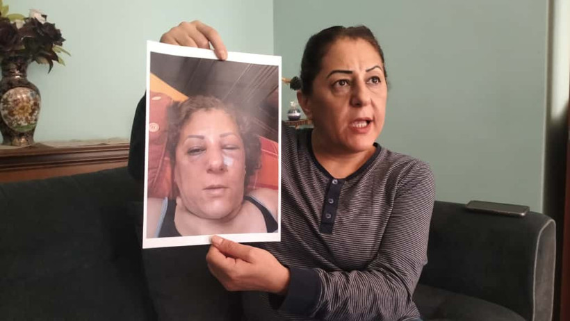 Ankara’da Kedi Besleyen Komşusuna Dehşeti Yaşattı! Annesi Saçını Tuttu, Oğlu Yumrukladı… Burnunda 3 Kırık Var - Resim : 4