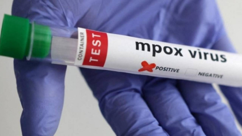 O Salgın Tekrardan Hortladı! Hızla Vakalar Artıyor, O Ülke Karantina Altına Alınabilir - Resim : 1