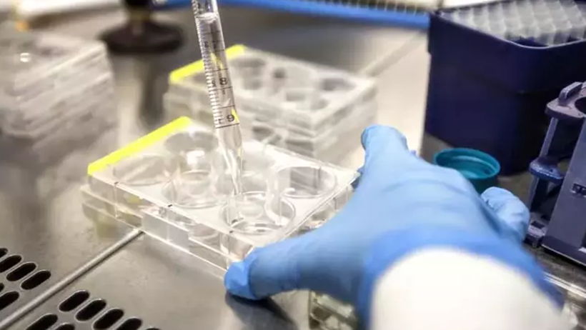 Yeni Salgın Kapıda! Türkiye’de de Görüldü, Belirtileri Grip ile Aynı… Test Yapılmadan Fark Edilmiyor - Resim : 1