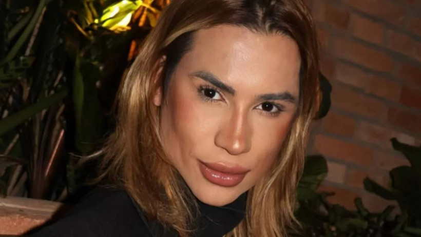 Estetik Ameliyatı Hayatına Mal Oldu! Brezilyalı Fenomenin Acı Ölümü - Resim : 1