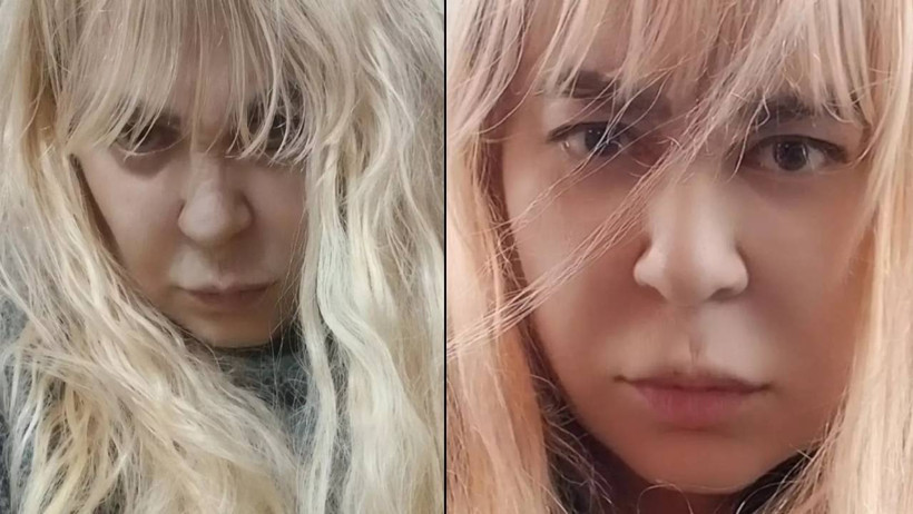 Vasiyetini Açıklamıştı... Zerrin Özer Hastaneden Paylaştı! Sevenlerini Üzen Haber - Resim : 1