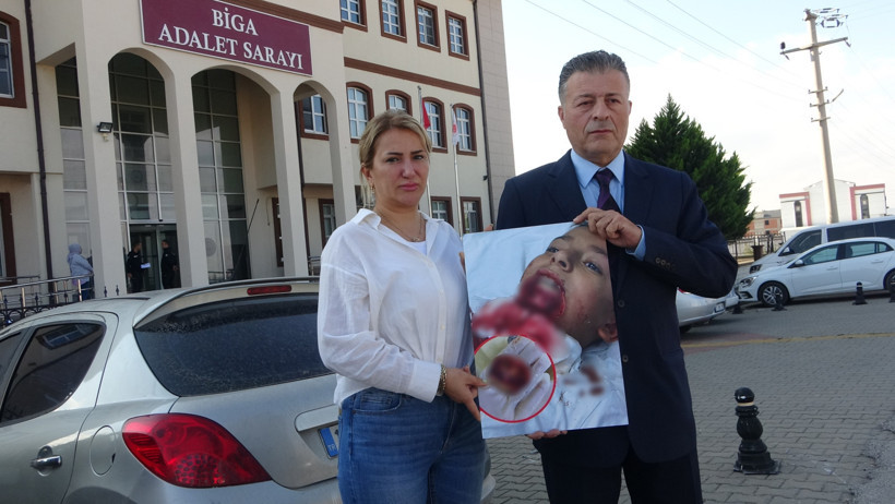 Okulda Demir Çit Faciası! Küçük Kuzey'in Çenesi Koptu - Resim : 2
