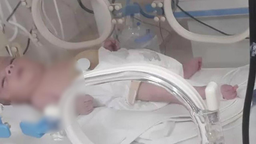 İkinci Yenidoğan Skandalı: Doğuştan Engelli Sandılar, Meğer Darbedilmiş! Aile Yıllar Sonra Öğrendi - Resim : 2