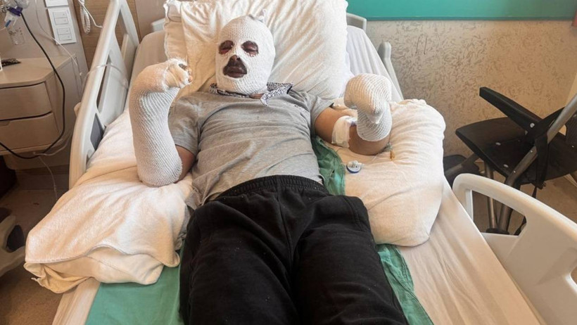 Kars'ta Mutfakta Dehşet: &Ccedil;ay Demlemek İsterken Canından Oluyordu - Resim : 2