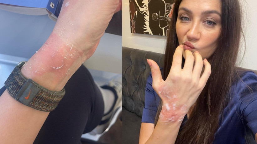 Eşref R&uuml;ya Setinde Korkutan Kaza: Ceren Benderlioğlu&rsquo;nun Zor Anları - Resim : 1