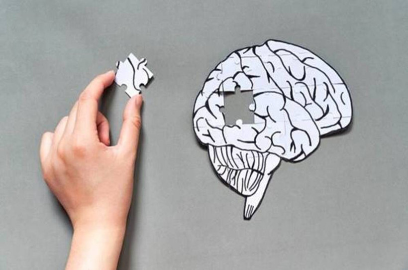 Alzheimer’da Umut Veren İlaçlar Devrede! ‘Kesin Tedavi Henüz Yok Ama Yol Alınıyor’ - Resim : 2