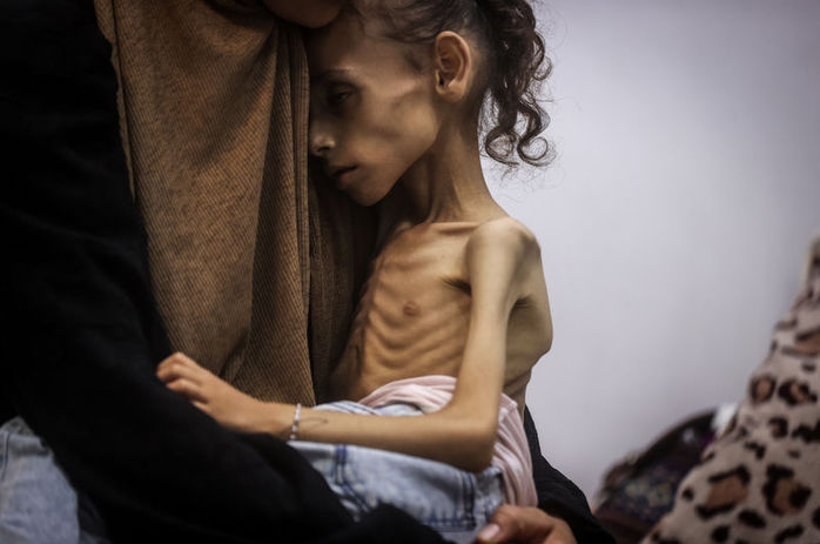 Gazze'deki İnsanlık Dramı Derinleşiyor... 10 Kiloluk En Ağır Vicdani Yük... - Resim : 1