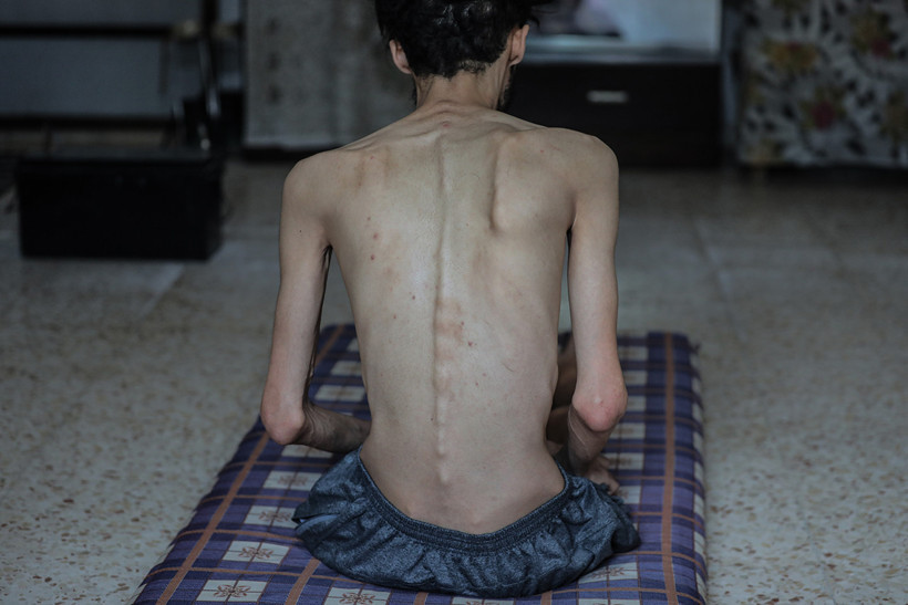 Gazze'de Kıtlıktan Hayatını Kaybedenlerin Sayısı Yine Arttı - Resim : 1