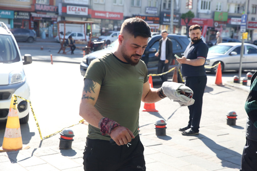 Bayram Namazı Bitti, Acil Servisler Doldu! 'Acemi Kasaplar' Yine Kendilerini Doğradı - Resim : 2