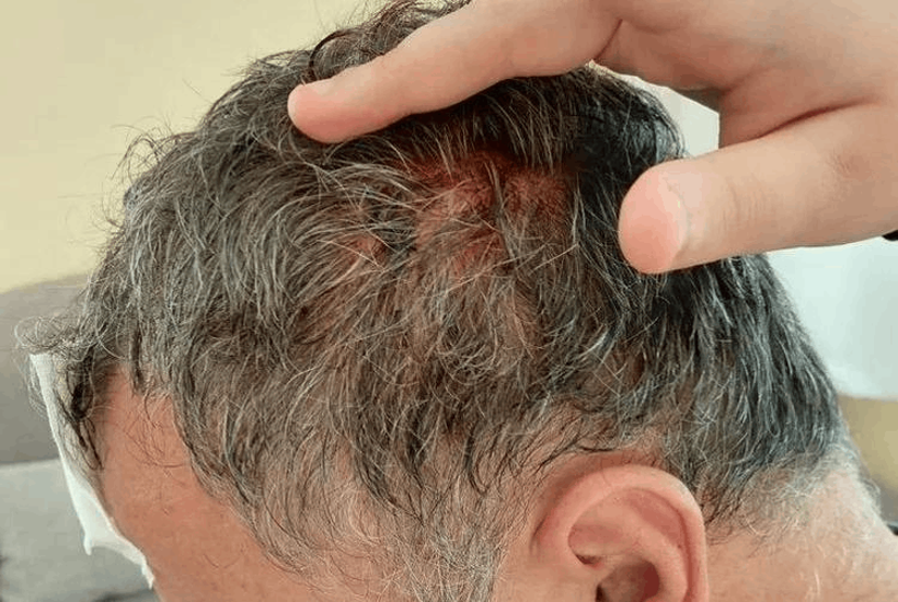 Yazlıkçı Aile Tatilde Hayatının Şokunu Yaşadı: Bayılana Kadar Demir Sopayla Darp Edildiler - Resim : 1