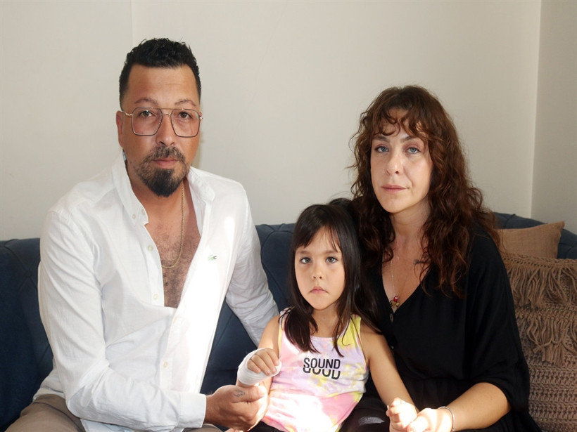 4 Yaşındaki Mavi'nin Parmağı Okulda Koptu! Yönetimin Akılalmaz İhmalleri... - Resim : 2