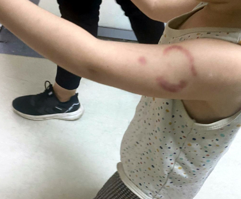 Kan Donduran Olay! Daha 3 Yaşında... Baba, Dehşeti Çocuğu Ağlayınca Fark Etti: 'Bir Daha Kreşe Göndermeyeceğim!' - Resim : 1