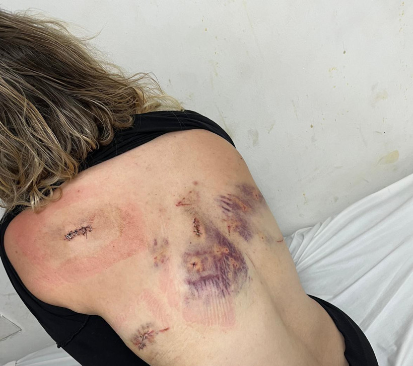 7 Kez Uzaklaştırma Kararı Aldırdı! Eski Sevgilisinin Bıçaklı Saldırısına Uğradı: 'Bıçak Kırılmasaydı Yaşama Şansım Yoktu' - Resim : 3