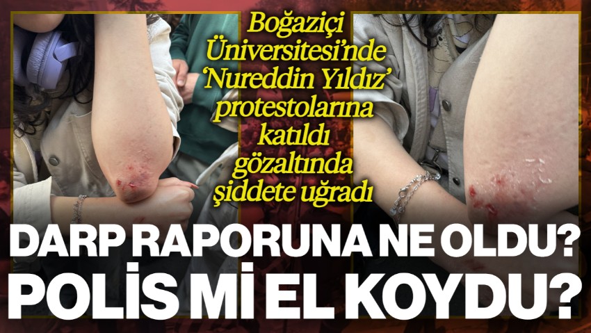 Boğaziçi Üniversitesi'ndeki 'Nureddin Yıldız' Protestolarında Gözaltına Alındı, Şiddete Uğradı! Darp Raporuna Polis mi El Koydu?