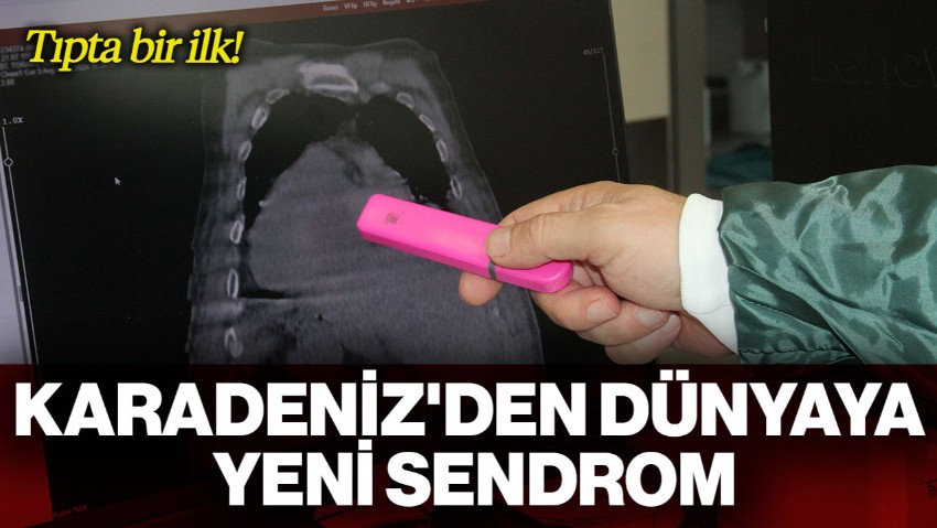 Tıpta Bir İlk: Karadeniz'den Dünyaya Yeni Bir Sendrom