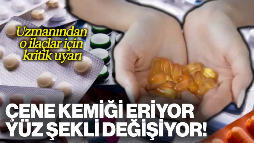 Uzmanından O İlaçlar İçin Kritik Uyarı! Çene Kemiği Eriyor, Yüz Şekli Değişiyor