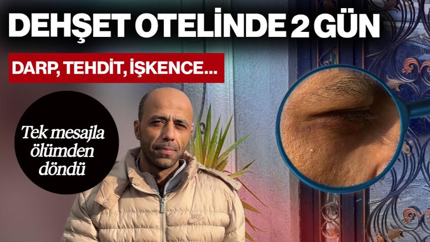 Dehşet Otelinde 2 Gün! Darp, Tehdit, İşkence… Tek Mesajla Ölümden Döndü