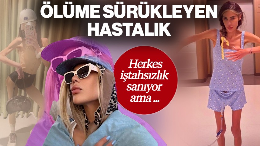 Nihal Candan’ı Ölüme Sürükleyen Hastalık! Anoreksiya Nervoza Nedir? Herkes İştahsızlık Sanıyor Ama Tehlike Daha Büyük