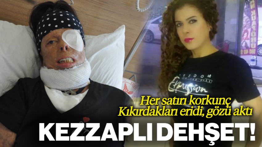 Kezzaplı Dehşet! Kıkırdakları Eridi, Gözü Aktı: Yüzünü Yıkayamasın Diye Elektriği ve Suyu Kesmiş...