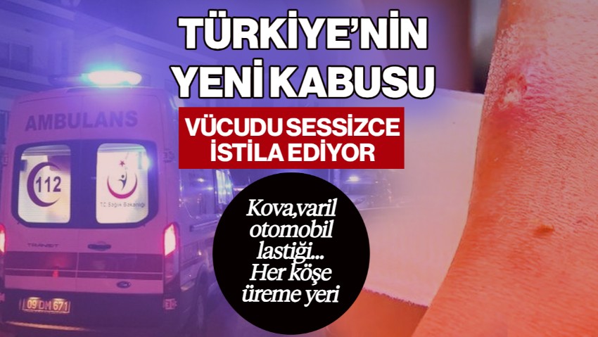 Türkiye’nin Yeni Kabusu, Vücudu Sessizce İstila Ediyor! Kova, Varil, Otomobil Lastiği… Her Köşe Üreme Yeri