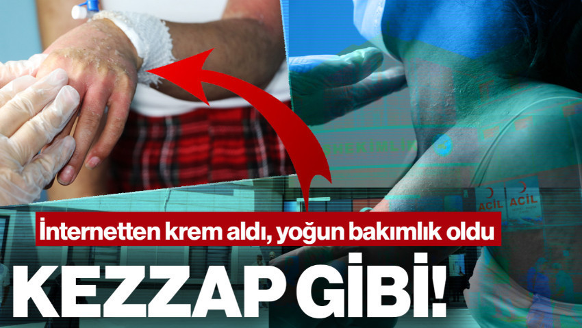 İnternetten Aldığı Kremde Kezzap Etkili Madde Çıktı! Bütün Hayatı Karardı